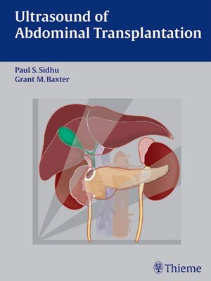 cover image of Ultrasound of Abdominal Transplantation